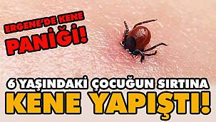 Ergene'de 6 Yaşındaki Çocuğun Sırtına Kene Yapıştı