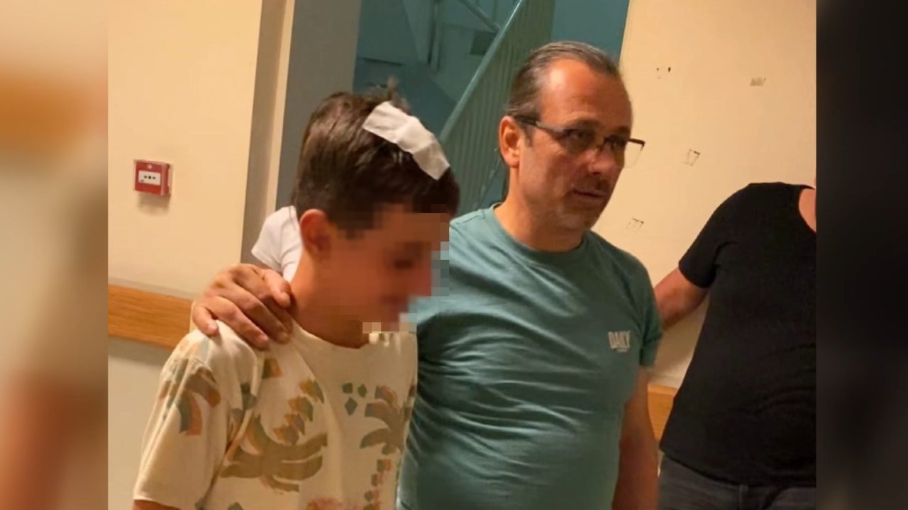 Sokakta oynayarken komşusunun başına şişe attığı çocuk yaralandı