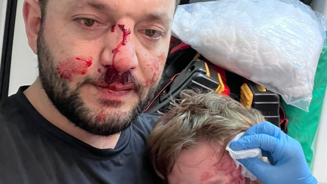 İkra ile babasının darbedilmesine ilişkin iddianame hazırlandı; çocuk skuter'ı 'silah' olarak sayıldı